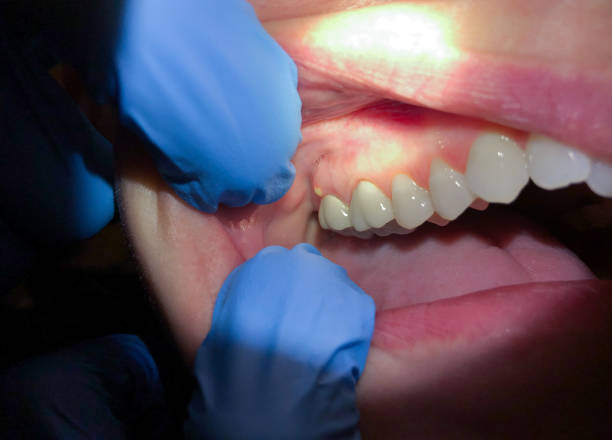 Best Weekend Emergency Dentist in Breckinridge Center, KY