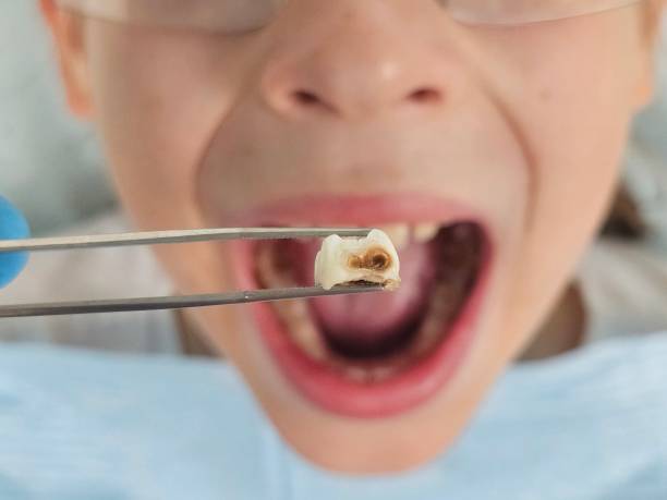 Best Emergency Denture Repair in Breckinridge Center, KY