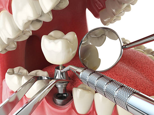 Best Emergency TMJ Treatment in Breckinridge Center, KY